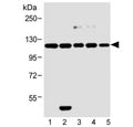 Western blot testing of human 1) MCF-7, 2) HeLa, 3) SH-SY5Y, 4) 293T and 5) rat PC-12 cell lysate with Insulin receptor-related antibody. Expected molecular weight: ~80 kDa, 144 kDa.