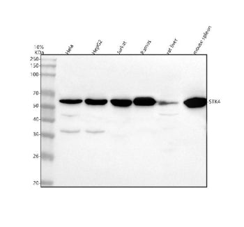 Western blot analysis of MST1/STK4 using anti-MST1 antibody. Lane 1: human Hela whole cell lysates, Lane 2: human HepG2 whole cell lysates, Lane 3: human Jurkat whole cell lysates, Lane 4: human Ramos whole cell lysates, Lane 5: rat liver tissue lysates, Lane 6: mouse spleen tissue lysates. After electrophoresis, proteins were transferred to a nitrocellulose membrane at 150 mA for 50-90 min. Blocked the membrane with 5% non-fat milk/TBS for 1.5 hour at RT.
