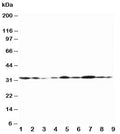 Western blot testing of Connexin 32 antibody and Lane 1: rat heart; 2: (r) heart; 3: (r) skeletal muscle; 4: (r) brain; 5: human MCF-7; 6: (h) HeLa; 7: (h) SMMC-7721; 8: (h) Jurkat; 9: (h) COLO320 lysate. Predicted molecular weight ~32 kDa.