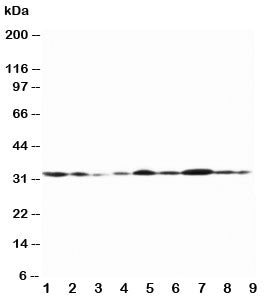 Western blot testing of Connexin 32 antibody and Lane 1: rat heart; 2: (r) heart; 3: (r) skeletal muscle; 4: (r) brain; 5: human MCF-7; 6: (h) HeLa; 7: (h) SMMC-7721; 8: (h) Jurkat; 9: (h) COLO320 lysate. Predicted molecular weight ~32 kDa.