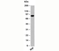 Western blot testing of human samples with IKKb antibody IKB355 at 2ug/ml.