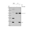 Immunoprecipitating TUSC1 in Hela whole cell lysate. Western blot analysis of TUSC1 using anti-TUSC1 antibody. Lane 1: Hela whole cell lysates (30ug), Lane 2: Rabbit control IgG instead of anti-TUSC1 antibody in Hela whole cell lysate, Lane 3: anti-TUSC1 antibody (2ug) + Hela whole cell lysate (500ug). After electrophoresis, proteins were transferred to a membrane.
