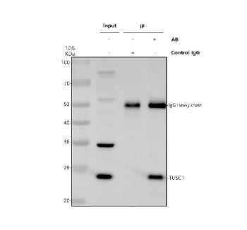 Immunoprecipitating TUSC1 in Hela whole cell lysate. Western blot analysis of TUSC1 using anti-TUSC1 antibody. Lane 1: Hela whole cell lysates (30ug), Lane 2: Rabbit control IgG instead of anti-TUSC1 antibody in Hela whole cell lysate, Lane 3: anti-TUSC1 antibody (2ug) + Hela whole cell lysate (500ug). After electrophoresis, proteins were transferred to a membrane.