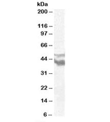Western blot testing of human brain frontal cortex lysate with DYX1C1 antibody at 0.5ug/ml. Predicted molecular weight: ~48/44/44kDa (isoforms a/b/c).