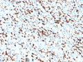 IHC staining of FFPE human spleen tissue with S100A4 antibody (clone S100A4/6802). Inset: PBS used in place of primary Ab (secondary Ab negative control). HIER: boil tissue sections in pH 9 10mM Tris with 1mM EDTA for 20 min and allow to cool before testing.