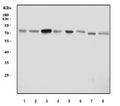 Western blot testing of 1) human T-47D, 2) human HeLa, 3) human U-251, 4) human RT4, 5) rat liver, 6) rat pancreas, 7) mouse liver and 8) mouse pancreas tissue lysate with ACP2 antibody. Predicted molecular weight ~76 kDa.