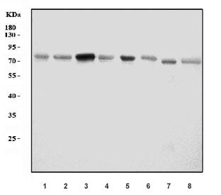 Western blot testing of 1) human T-47D, 2) human HeLa, 3) human U-251, 4) human RT4, 5) rat liver, 6) rat pancreas, 7) mouse liver and 8) mouse pancreas tissue lysate with ACP2 antibody. Predicted molecular weight ~76 kDa.