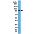 Western blot testing of mouse brain lysate with recombinant PSD95 antibody at 1:8000 dilution. Predicted molecular weight ~80 kDa but often observed at 90~95 kDa.