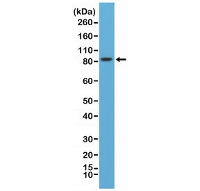 Western blot testing of mouse brain lysate with recombinant PSD95 antibody at 1:8000 dilution. Predicted molecular weight ~80 kDa but often observed at 90~95 kDa.