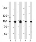 Western blot analysis of lysate from mouse 1) NIH3T3 cell line, 2) brain, 3) heart, 4) pancreas and 5) rat brain tissue lysate using Ephb1 antibody at 1:1000.
