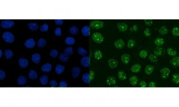 Immunofluorescent staining of FFPE human A431 cells with XRCC1 antibody (green) and DAPI nuclear stain (blue). HIER: steam section in pH6 citrate buffer for 20 min.