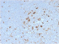 IHC staining of FFPE human tonsil with recombinant CD68 antibody (clone C68/2908R). HIER: boil tissue sections in pH 9 10mM Tris with 1mM EDTA for 10-20 min followed by cooling at RT for 20 min.