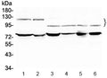 Western blot testing of 1) rat testis, 2) mouse testis, 3) human HeLa, 4) human A549 and 6) human SK-OV-3 lysate with NFATC4 antibody at 0.5ug/ml. Predicted molecular weight ~95 kDa, also can be observed at 120-140 kDa.
