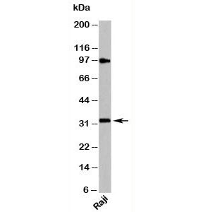 Western blot testing of human samples with MyD88 antibody at 4ug/ml. Predicted molecular weight: 33 kDa