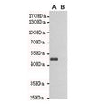 Western blot testing of TLR3 A) transfected and (B) untransfected CHO-K1 cell lysate with TLR3 antibody at 1:1000. Expected molecular weight of the partial protein: ~50 kDa.