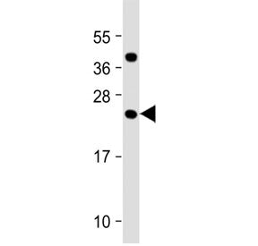 Western blot testing of human testis tissue lysate with FAM3A antibody at 1:2000. Predicted molecular weight ~25 kDa.