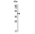 Western blot testing of human A375 cell lysate with Estrogen-Related Receptor Alpha antibody. Expected molecular weight: 46-52 kDa.