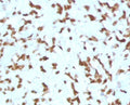 IHC staining of FFPE human liver tissue with Cathepsin D antibody (clone CTPD-1). HIER: boil tissue sections in pH 9 10mM Tris with 1mM EDTA for 10-20 min and allow to cool before testing.