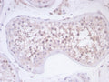 IHC staining of FFPE human testis tissue with Survivin antibody (clone BIRC5/7778). HIER: boil tissue sections in pH 9 10mM Tris with 1mM EDTA for 20 min and allow to cool before testing.