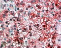 IHC testing of FFPE human adrenal cortex with AXIN1 antibody at 4ug/ml. HIER: steamed with pH6 citrate buffer, AP-staining.