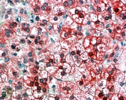 IHC testing of FFPE human adrenal cortex with AXIN1 antibody at 4ug/ml. HIER: steamed with pH6 citrate buffer, AP-staining.