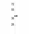 Western blot analysis of IGHM antibody and T47D lysate.