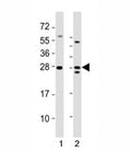 Western blot testing of Lin28a antibody at 1:2000 dilution. Lane 1: mouse F9 lysate; 2: human NCCIT lysate; Predicted molecular weight ~ 23 kDa.