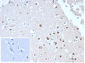IHC staining of FFPE human cerebellum tissue with recombinant NeuN antibody (clone NeuN/288R). Negative control inset: PBS used instead of primary antibody to control for secondary Ab binding. HIER: boil tissue sections in pH 9 10mM Tris with 1mM EDTA for 20 min and allow to cool before testing.