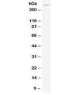 Western blot testing of human HeLa lysate with APOB antibody at 0.5ug/ml. Predicted molecular weight: ~516 kDa (ApoB-100), ~240 kDa (ApoB-48).