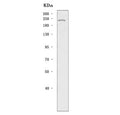 Western blot testing of mouse testis tissue lysate with DNA methyltransferase 1 antibody. Predicted molecular weight: 180-200 kDa.