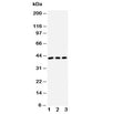 Western blot testing of DAPK2 antibody and Lane 1: U87; 2: MCF-7; 3: SMMC-7721 cell lysate
