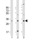 Western blot testing of human 1) U-2OS, 2) U-251 MG and 3) A431 cell lysate with FAM125A antibody at 1:2000. Predicted molecular weight: 29 kDa.