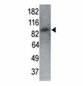 MARK1 antibody used in western blot to detect MARK1 in P7 mouse whole brain lysate (60 ug) at 1:250. Courtesy of Dr Shengli Zhao, Duke University Medical Center.