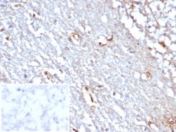 IHC staining of FFPE human cerebellum tissue with STAT6 antibody (clone STAT6/7774R). Inset: PBS used in place of primary Ab (secondary Ab negative control). HIER: boil tissue sections in pH 9 10mM Tris with 1mM EDTA for 20 min and allow to cool before testing.