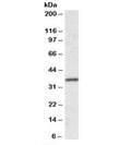 Western blot testing of human colon lysate with HOXA4 antibody at 0.1ug/ml. Predicted molecular weight: ~35kDa.