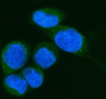 Immunofluorescent staining of IFI44L using anti-IFI44L antibody (green). IFI44L was detected in an immunocytochemical section of SiHa cells. Enzyme antigen retrieval was performed using IHC enzyme antigen retrieval reagent for 15 mins. The cells were blocked with 10% goat serum. And then incubated with 5 ug/ml rabbit anti-IFI44L antibody overnight at 4oC. DyLight 488 Conjugated Goat Anti-Rabbit IgG was used as secondary antibody at 1:500 dilution and incubated for 30 min at 37oC.