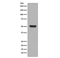 Western blot testing of human HaCat cell lysate with Cytokeratin 16 antibody. Predicted molecular weight ~51 kDa.