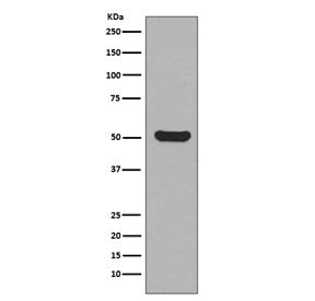 Western blot testing of human HaCat cell lysate with Cytokeratin 16 antibody. Predicted molecular weight ~51 kDa.