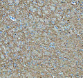 Immunohistochemical staining of SNCB using anti-SNCB antibody. SNCB was detected in a paraffin-embedded section of mouse cerebellum tissue. Heat mediated antigen retrieval was performed in EDTA buffer (pH 8.0, epitope retrieval solution). The tissue section was blocked with 10% goat serum. The tissue section was then incubated with 2 ug/ml rabbit anti-SNCB antibody overnight at 4oC. Peroxidase Conjugated Goat Anti-rabbit IgG was used as secondary antibody and incubated for 30 min at 37oC.