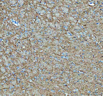 Immunohistochemical staining of SNCB using anti-SNCB antibody. SNCB was detected in a paraffin-embedded section of mouse cerebellum tissue. Heat mediated antigen retrieval was performed in EDTA buffer (pH 8.0, epitope retrieval solution). The tissue section was blocked with 10% goat serum. The tissue section was then incubated with 2 ug/ml rabbit anti-SNCB antibody overnight at 4oC. Peroxidase Conjugated Goat Anti-rabbit IgG was used as secondary antibody and incubated for 30 min at 37oC.