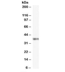 Western blot testing of Jurkat cell lysate with GBX2 antibody at 0.1ug/ml. Predicted molecular weight ~37kDa.