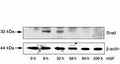 HepG2 cells were incubated with HGF for the indicated time periods. LiCl and MG132 were added 8 hr before lysis of the cells. SNAIL protein and beta actin (loading control) levels were analyzed by western blot.