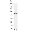 Western blot testing of c-Fos antibody and Lane 1: HT1080; 2: COLO320 cell lysate. Expected molecular weight: ~40 kDa (unmodified), 53-68 kDa (phosphorylated).