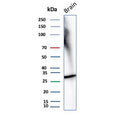 Western blot testing of human brain tissue lysate with recombinant CALB2 antibody. Predicted molecular weight ~29 kDa.