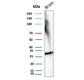 Western blot testing of human brain tissue lysate with recombinant CALB2 antibody. Predicted molecular weight ~29 kDa.