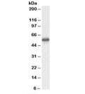 Western blot testing of human testis lysate with CSN1 antibody at 0.5ug/ml. Predicted molecular weight: ~58kDa.
