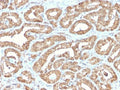 IHC staining of FFPE human prostate tissue with recombinant ODC1 antibody. HIER: boil tissue sections in pH6, 10mM citrate buffer, for 10-20 min and allow to cool before testing.