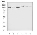 Western blot testing of 1) human HeLa, 2) human Jurkat, 3) human K562, 4) monkey COS-7, 5) rat liver and 6) rat heart lysate with DNMT3B antibody. Predicted molecular weight: 95 kDa.