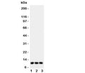 Western blot testing of CCL1 antibody and Lane 1: U87; 2: MCF-7; 3: COLO320 lysate. Expected/observed size ~10 kDa.
