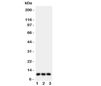Western blot testing of CCL1 antibody and Lane 1: U87; 2: MCF-7; 3: COLO320 lysate. Expected/observed size ~10 kDa.